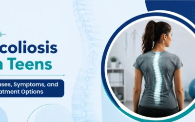 Scoliosis in Teens: Causes, Symptoms, and Treatment Options