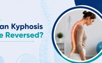 Can Kyphosis Be Reversed?