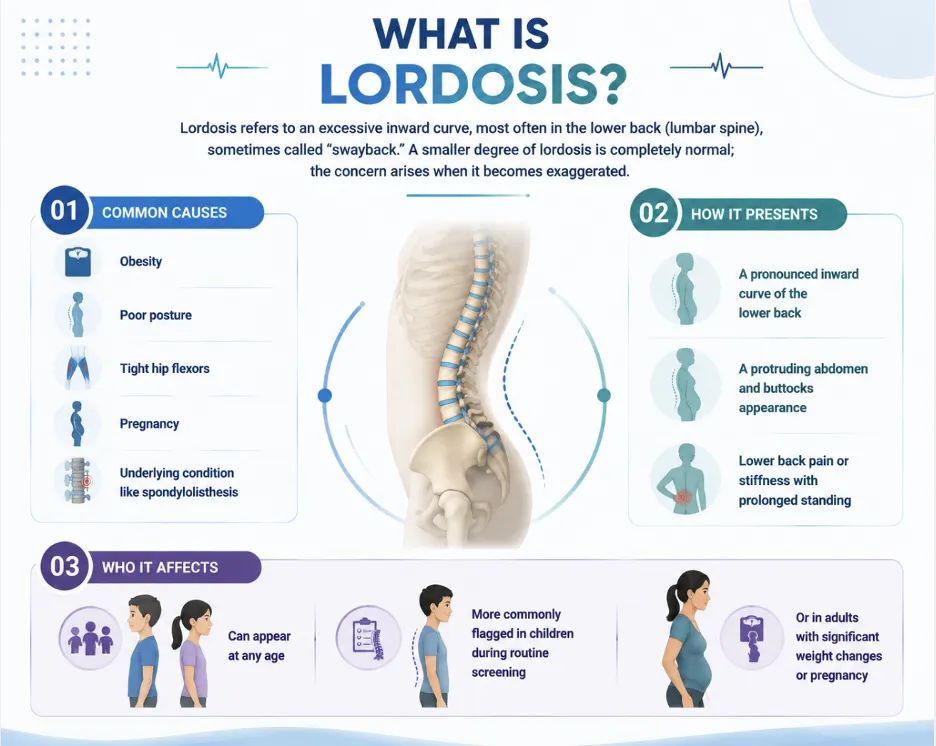 Scoliosis vs Kyphosis vs Lordosis Picture 4