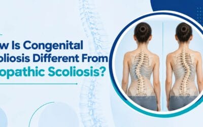 How Is Congenital Scoliosis Different From Idiopathic Scoliosis?